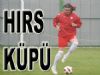 Bolu'nun Lugano'su Hırs Küpü